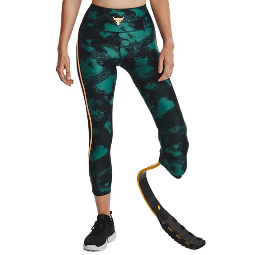 A person wearing green and black patterned leggings with a prosthetic running blade, paired with a black and white sneaker.