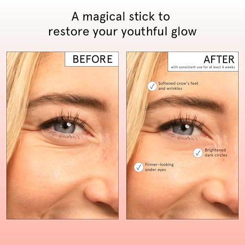 A comparison showing the effects of using a skincare stick for at least four weeks, highlighting softened crow's feet and wrinkles, brightened dark circles, and firmer-looking under eyes.